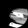 SPORK, NICO - 22.03.1976 - 02.08.2022 - CT obere Extremität - 17:51:17